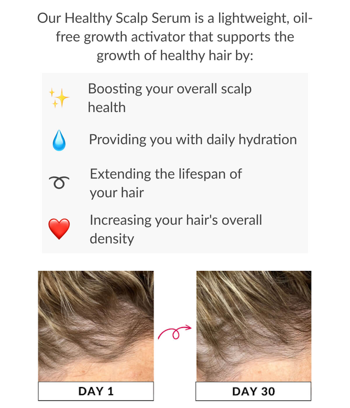 Our Healthy Scalp Serum is a lightweight, oil-free growth activator that supports the growth of healthy hair by: