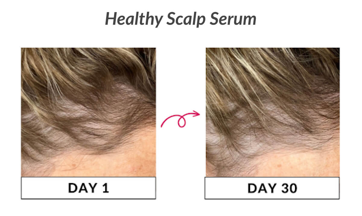 Healthy Scalp Serum